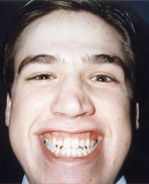 face1.gif (188084 bytes)